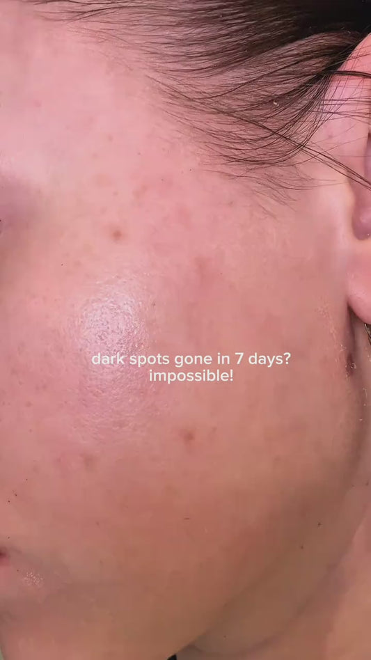 كريم تفتيح المسام والتصبغات من سليماكس الكورية 🇰🇷
 Pore + Dark Spot Brightening Cream
تركيبة موجّهة لتوحيد اللون وتحسين ملمس البشرة