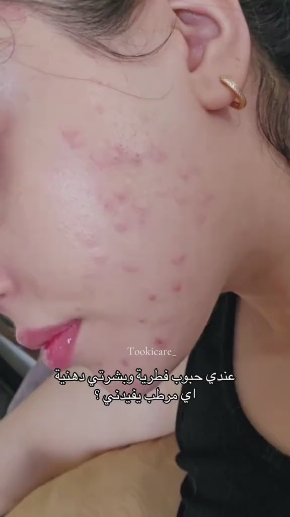 ايونيك سنتيلا كريموجل