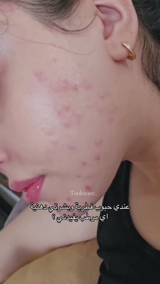 ايونيك سنتيلا كريموجل
