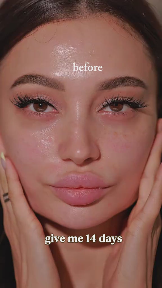الفا اربوتين بلص ترانيكساميك أسيد من توسوونك الكورية 
🇰🇷 TOSOWOONG Alpha Arbutin + TXA Cream
✨ كريم تفتيح متطور يساعد على تقليل التصبغات والبقع الداكنة وتوحيد لون البشرة، ليمنحها إشراقة ومظهراً أكثر صفاءً مع الاستخدام المنتظم.