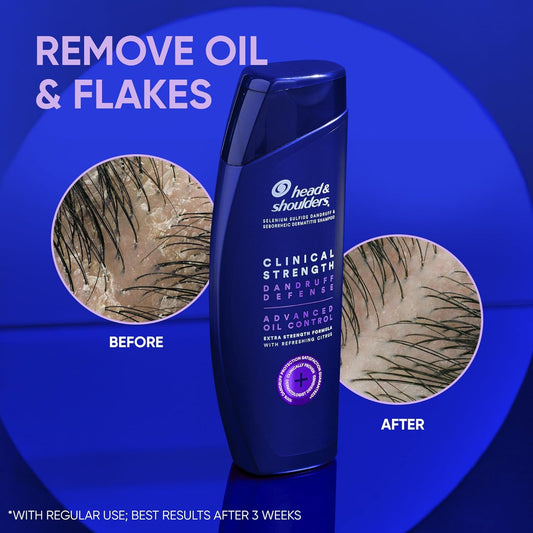 شامبو هيد اند شولدرز كلينيكال سترنث الامريكي  🇺🇲
Head & Shoulders Clinical Strength Dandruff Defense – Advanced Oil Control
شامبو علاجي بتركيبة متطورة يساعد على التخلص من القشرة والتحكم بالزيوت الزائدة مع تنظيف عميق لفروة الرأس